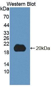 DNT / NT5C Antibody - Western Blot; Sample: Recombinant protein.