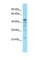 DNT / NT5C Antibody - NT5C antibody Western blot of 721_B Cell lysate. Antibody concentration 1 ug/ml.  This image was taken for the unconjugated form of this product. Other forms have not been tested.