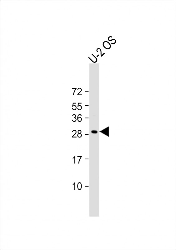 DNT / NT5C Antibody - Anti-NT5C Antibody (C-Term) at 1:2000 dilution + U-2 OS whole cell lysate Lysates/proteins at 20 µg per lane. Secondary Goat Anti-Rabbit IgG, (H+L), Peroxidase conjugated at 1/10000 dilution. Predicted band size: 23 kDa Blocking/Dilution buffer: 5% NFDM/TBST.