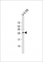 DNT / NT5C Antibody - Anti-NT5C Antibody (C-Term) at 1:2000 dilution + U-2 OS whole cell lysate Lysates/proteins at 20 µg per lane. Secondary Goat Anti-Rabbit IgG, (H+L), Peroxidase conjugated at 1/10000 dilution. Predicted band size: 23 kDa Blocking/Dilution buffer: 5% NFDM/TBST.