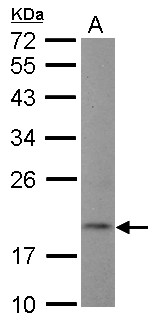 DNT / NT5C Antibody - Sample (30 ug of whole cell lysate) A: Raji 12% SDS PAGE NT5C antibody diluted at 1:1000