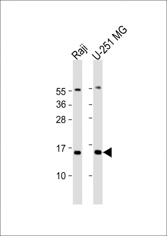 DNT / NT5C Antibody - All lanes: Anti-NT5C Antibody (N-Term) at 1:2000 dilution Lane 1: Raji whole cell lysate Lane 2: U-251 MG whole cell lysate Lysates/proteins at 20 µg per lane. Secondary Goat Anti-Rabbit IgG, (H+L), Peroxidase conjugated at 1/10000 dilution. Predicted band size: 23 kDa Blocking/Dilution buffer: 5% NFDM/TBST.