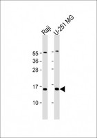 DNT / NT5C Antibody - All lanes: Anti-NT5C Antibody (N-Term) at 1:2000 dilution Lane 1: Raji whole cell lysate Lane 2: U-251 MG whole cell lysate Lysates/proteins at 20 µg per lane. Secondary Goat Anti-Rabbit IgG, (H+L), Peroxidase conjugated at 1/10000 dilution. Predicted band size: 23 kDa Blocking/Dilution buffer: 5% NFDM/TBST.
