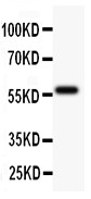 DNTT / TdT Antibody - TdT antibody Western blot. All lanes: Anti TDT at 0.5 ug/ml. WB: JURKAT Whole Cell Lysate at 40 ug. Predicted band size: 58 kD . Observed band size: 58 kD.