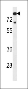 DNTT / TdT Antibody - TdT Antibody western blot of MDA-MB453 cell line lysates (35 ug/lane). The TdT antibody detected the TdT protein (arrow).