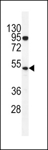 DNTT / TdT Antibody - TdT Antibody western blot of K562 cell line lysates (35 ug/lane). The TdT antibody detected the TdT protein (arrow).