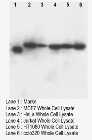 DNTT / TdT Antibody -  This image was taken for the unconjugated form of this product. Other forms have not been tested.