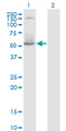 DNTT / TdT Antibody - Western Blot analysis of DNTT expression in transfected 293T cell line by DNTT monoclonal antibody (M01), clone 4H5.Lane 1: DNTT transfected lysate (Predicted MW: 58.4 KDa).Lane 2: Non-transfected lysate.