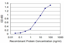 DNTT / TdT Antibody - Detection limit for recombinant GST tagged DNTT is approximately 0.1 ng/ml as a capture antibody.