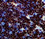 DNTT / TdT Antibody - IHC of TdT on FFPE Thymus tissue. This image was taken for the unmodified form of this product. Other forms have not been tested.