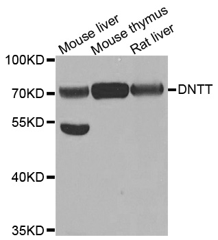 DNTT / TdT Antibody - Western blot analysis of extracts of various cell lines.