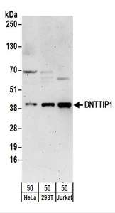 DNTTIP1 / TDIF1 Antibody - Detection of Human DNTTIP1 by Western Blot. Samples: Whole cell lysate (50 ug) from HeLa, 293T, and Jurkat cells. Antibodies: Affinity purified rabbit anti-DNTTIP1 antibody used for WB at 0.1 ug/ml. Detection: Chemiluminescence with an exposure time of 3 minutes.