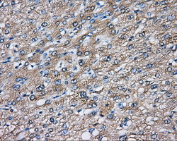 DNTTIP1 / TDIF1 Antibody - Immunohistochemical staining of paraffin-embedded liver tissue using anti-DNTTIP1 mouse monoclonal antibody. (Dilution 1:50).