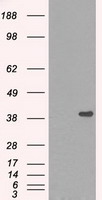DNTTIP1 / TDIF1 Antibody - HEK293T cells were transfected with the pCMV6-ENTRY control (Left lane) or pCMV6-ENTRY DNTTIP1 (Right lane) cDNA for 48 hrs and lysed. Equivalent amounts of cell lysates (5 ug per lane) were separated by SDS-PAGE and immunoblotted with anti-DNTTIP1.