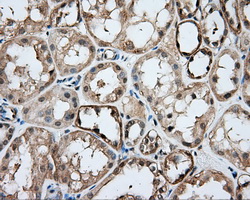 DNTTIP1 / TDIF1 Antibody - Immunohistochemical staining of paraffin-embedded Kidney tissue using anti-DNTTIP1 mouse monoclonal antibody. (Dilution 1:50).