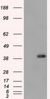 DNTTIP1 / TDIF1 Antibody - HEK293T cells were transfected with the pCMV6-ENTRY control (Left lane) or pCMV6-ENTRY DNTTIP1 (Right lane) cDNA for 48 hrs and lysed. Equivalent amounts of cell lysates (5 ug per lane) were separated by SDS-PAGE and immunoblotted with anti-DNTTIP1.