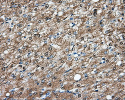 DNTTIP1 / TDIF1 Antibody - Immunohistochemical staining of paraffin-embedded liver tissue using anti-DNTTIP1 mouse monoclonal antibody. (Dilution 1:50).