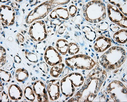 DNTTIP1 / TDIF1 Antibody - Immunohistochemical staining of paraffin-embedded Kidney tissue using anti-DNTTIP1 mouse monoclonal antibody. (Dilution 1:50).