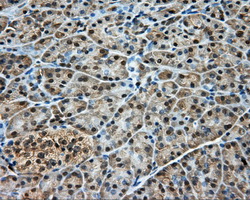 DNTTIP1 / TDIF1 Antibody - Immunohistochemical staining of paraffin-embedded pancreas tissue using anti-DNTTIP1 mouse monoclonal antibody. (Dilution 1:50).