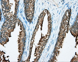 DNTTIP1 / TDIF1 Antibody - Immunohistochemical staining of paraffin-embedded prostate tissue using anti-DNTTIP1 mouse monoclonal antibody. (Dilution 1:50).