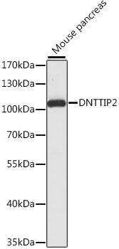 DNTTIP2 Antibody - Western blot analysis of extracts of mouse pancreas using DNTTIP2 Polyclonal Antibody at dilution of 1:1000.
