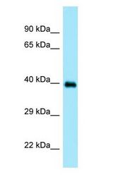 DOC2A Antibody - DOC2A antibody Western Blot of Placenta.  This image was taken for the unconjugated form of this product. Other forms have not been tested.