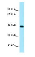 DOC2A Antibody - DOC2A antibody Western Blot of Placenta.  This image was taken for the unconjugated form of this product. Other forms have not been tested.