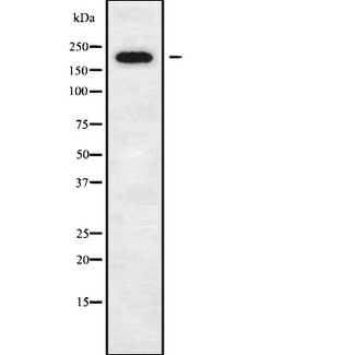 DOCK11 Antibody - Western blot analysis of DOCK11 using K562 whole cells lysates