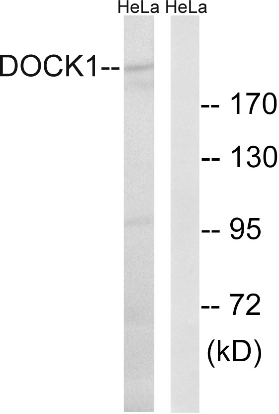 DOCK180 / DOCK1 Antibody - Western blot analysis of lysates from HeLa cells, using DOCK1 Antibody. The lane on the right is blocked with the synthesized peptide.