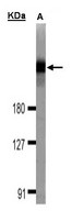 DOCK180 / DOCK1 Antibody - Sample (30 ug of whole cell lysate). A:293T. 7.5% SDS PAGE. DOCK180 / DOCK1 antibody diluted at 1:1000