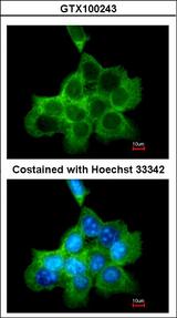 DOCK180 / DOCK1 Antibody - Immunofluorescence of methanol-fixed A431 using DOCK1/180 antibody at 1:200 dilution.