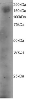 DOCK180 / DOCK1 Antibody - Antibody staining (4 ug/ml) of A431 lysate (RIPA buffer, 35 ug total protein per lane). Primary incubated for 12 hour. Detected by Western blot of chemiluminescence.