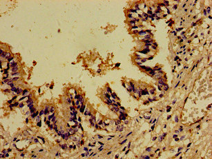 DOCK180 / DOCK1 Antibody - Immunohistochemistry image of paraffin-embedded human lung tissue at a dilution of 1:100