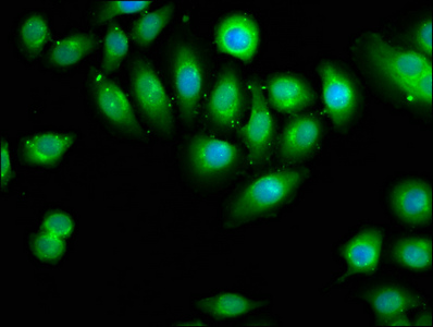 DOCK180 / DOCK1 Antibody - Immunofluorescence staining of A549 cells with DOCK1 Antibody at 1:66, counter-stained with DAPI. The cells were fixed in 4% formaldehyde, permeabilized using 0.2% Triton X-100 and blocked in 10% normal Goat Serum. The cells were then incubated with the antibody overnight at 4°C. The secondary antibody was Alexa Fluor 488-congugated AffiniPure Goat Anti-Rabbit IgG(H+L).