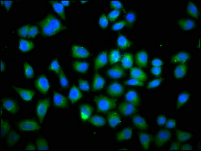 DOCK180 / DOCK1 Antibody - Immunofluorescence staining of Hela cells with DOCK1 Antibody at 1:66, counter-stained with DAPI. The cells were fixed in 4% formaldehyde, permeabilized using 0.2% Triton X-100 and blocked in 10% normal Goat Serum. The cells were then incubated with the antibody overnight at 4°C. The secondary antibody was Alexa Fluor 488-congugated AffiniPure Goat Anti-Rabbit IgG(H+L).