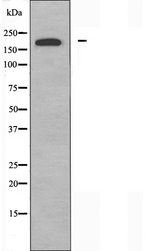 DOCK180 / DOCK1 Antibody - Western blot analysis of extracts of HeLa cells using DOCK1 antibody.