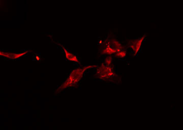 DOCK180 / DOCK1 Antibody - Staining HeLa cells by IF/ICC. The samples were fixed with PFA and permeabilized in 0.1% Triton X-100, then blocked in 10% serum for 45 min at 25°C. The primary antibody was diluted at 1:200 and incubated with the sample for 1 hour at 37°C. An Alexa Fluor 594 conjugated goat anti-rabbit IgG (H+L) antibody, diluted at 1/600, was used as secondary antibody.