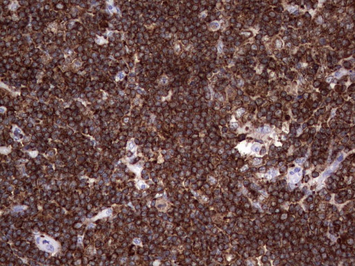 DOCK2 Antibody - IHC of paraffin-embedded Human lymph node tissue using anti-DOCK2 mouse monoclonal antibody. (Heat-induced epitope retrieval by 1 mM EDTA in 10mM Tris, pH8.5, 120°C for 3min).