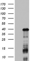 DOCK2 Antibody - HEK293T cells were transfected with the pCMV6-ENTRY control (Left lane) or pCMV6-ENTRY DOCK2 (Right lane) cDNA for 48 hrs and lysed. Equivalent amounts of cell lysates (5 ug per lane) were separated by SDS-PAGE and immunoblotted with anti-DOCK2.