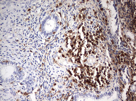 DOCK2 Antibody - IHC of paraffin-embedded Human endometrium tissue using anti-DOCK2 mouse monoclonal antibody. (Heat-induced epitope retrieval by 10mM citric buffer, pH6.0, 120°C for 3min).