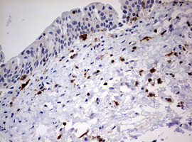 DOCK2 Antibody - IHC of paraffin-embedded Human bladder tissue using anti-DOCK2 mouse monoclonal antibody. (Heat-induced epitope retrieval by 10mM citric buffer, pH6.0, 120°C for 3min).