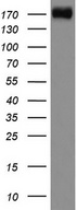DOCK2 Antibody - Western blot analysis of Jurkat cell lysate. (35ug) by using anti-DOCK2 monoclonal antibody.