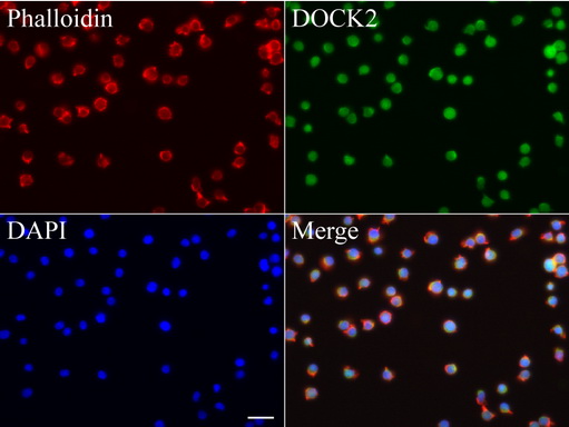 DOCK2 Antibody - Immunofluorescent staining of Jurkat cells using anti-DOCK2 mouse monoclonal antibody  green, 1:100). Actin filaments were labeled with Alexa Fluor® 594 Phalloidin. (red), and nuclear with DAPI. (blue). Scale bar, 20µm.