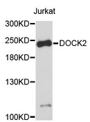 DOCK2 Antibody - Western blot analysis of extracts of Jurkat cells.