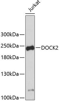 DOCK2 Antibody - Western blot analysis of extracts of Jurkat cells using DOCK2 Polyclonal Antibody.