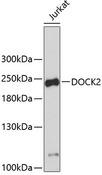 DOCK2 Antibody - Western blot analysis of extracts of Jurkat cells using DOCK2 Polyclonal Antibody.