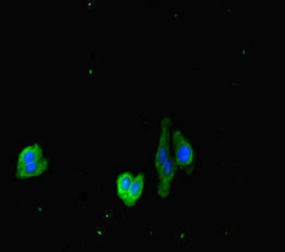 DOCK3 Antibody - Immunofluorescent analysis of HepG2 cells diluted at 1:100 and Alexa Fluor 488-congugated AffiniPure Goat Anti-Rabbit IgG(H+L)