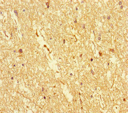 DOCK3 Antibody - Immunohistochemistry of paraffin-embedded human brain tissue at dilution of 1:100