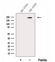 DOCK3 Antibody - Western blot analysis of extracts of SH-SY5Y cells using DOCK3;MOCA antibody. The lane on the left was treated with blocking peptide.