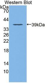 DOCK4 Antibody - Western blot of DOCK4 antibody.